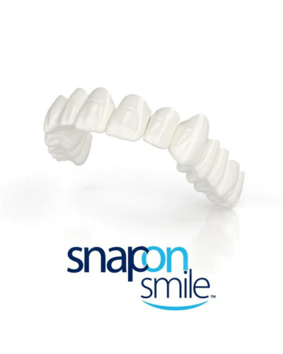 Snap-on Smile: Transform Your Smile Instantly