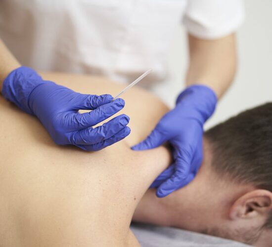 Dry needling therapy