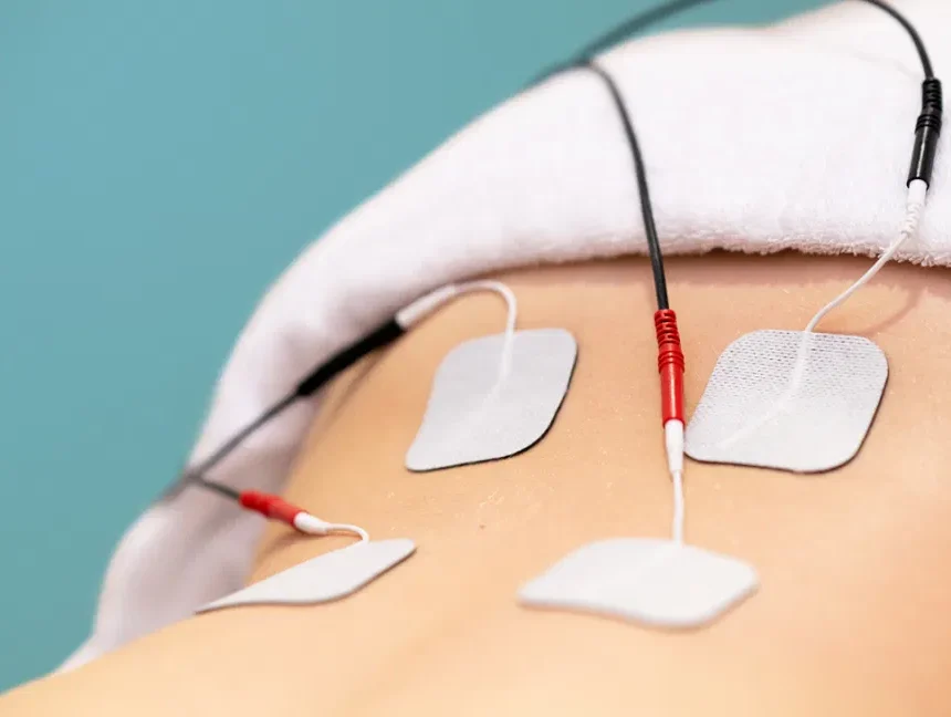 Perfect Dry needling Dubai Therapy at RamaCare