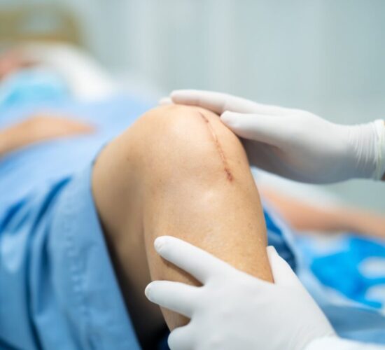 Wound Stitching Services