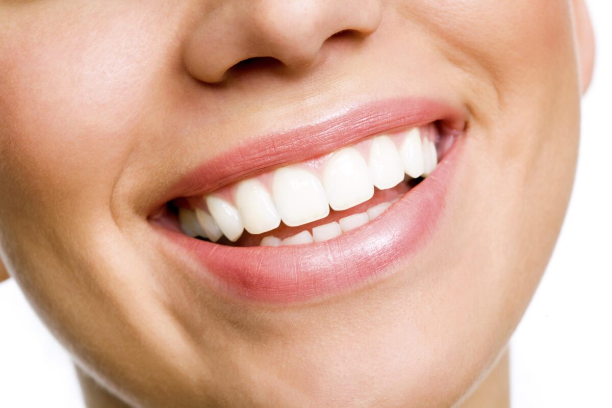 How Much Does Teeth Whitening Cost in Dubai