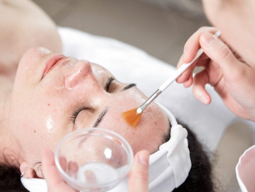 How Long Does a Chemical Peel Take to Heal?