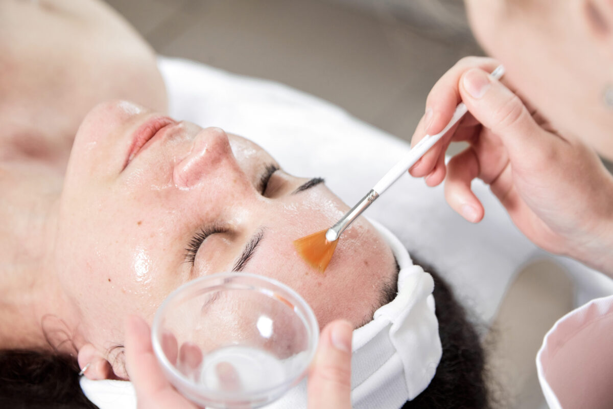 How Long Does a Chemical Peel Take to Heal?