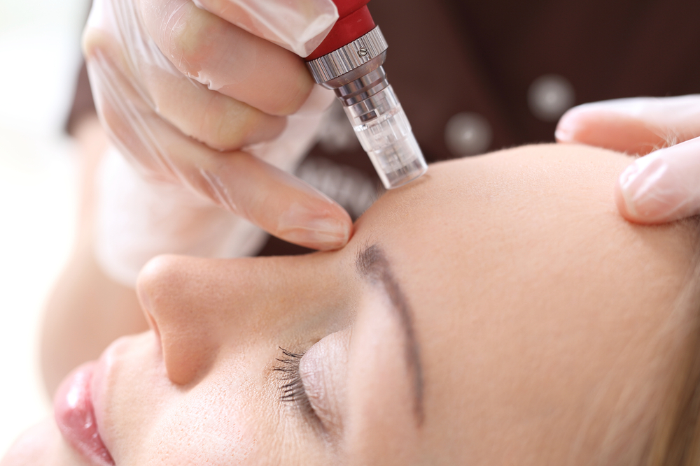 How Often Can You Do Mesotherapy